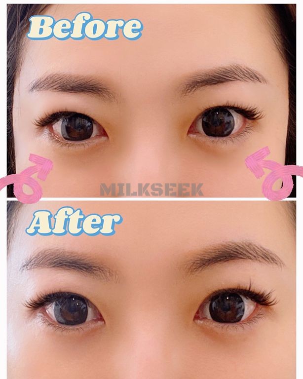 给我们的双眸来个spa按摩护理吧–檀凡肌肤护理中心5MilkSeek都市体验网